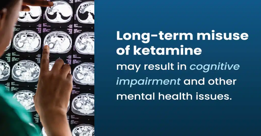 Doctor examining brain scans. White text: Long-term abuse of ketamine may result in cognitive impairment and other mental health issues.
