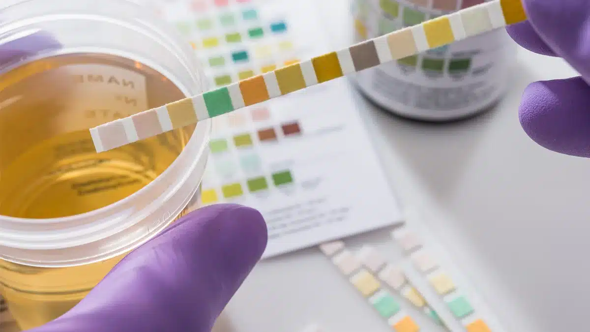 Methamphetamines have a prolonged detection time in urine compared to some other substances. Factors such as frequency of use and metabolism influence the duration of meth detection in urine. Natural detox and medical detox methods can aid in eliminating methamphetamine from the body.