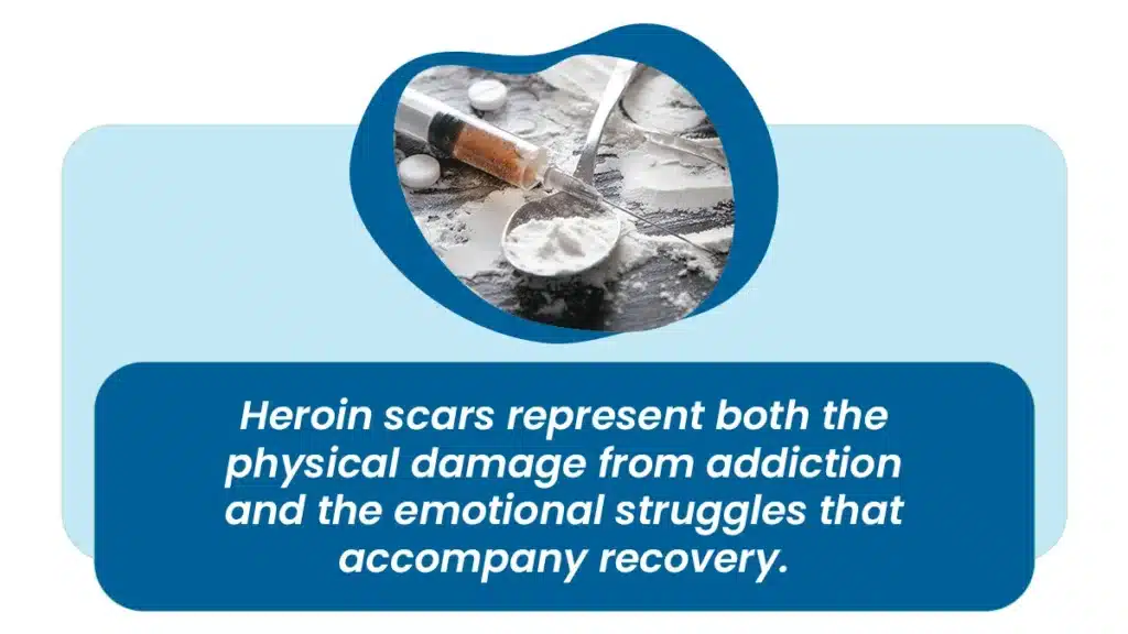 Heroin scars represent both the physical damage from addiction and the emotional struggles that accompany recovery.
